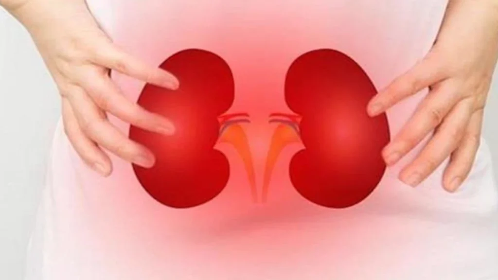 Kidney Disease
