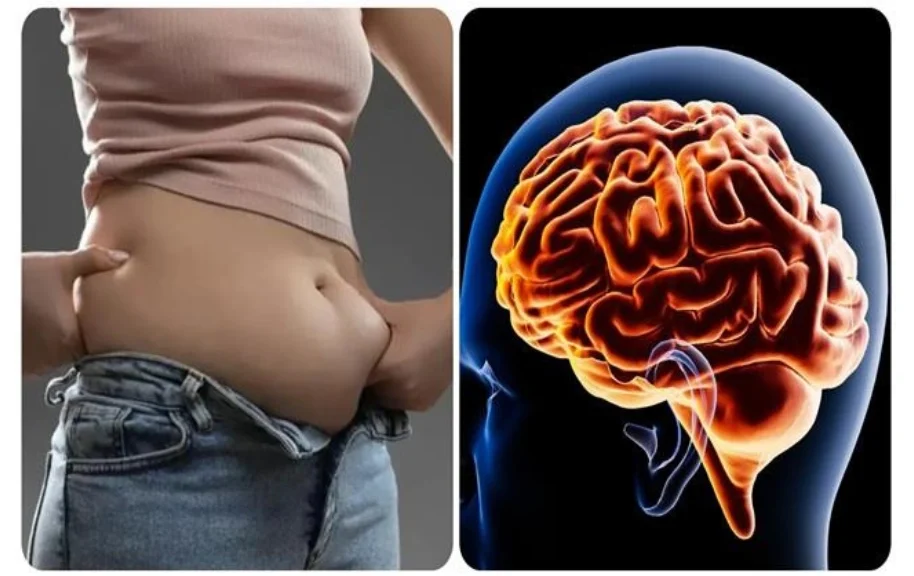 Visceral fat